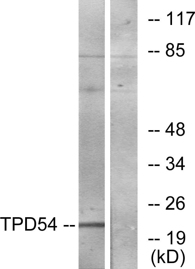 TPD52L2 / HD54 Antibody (aa141-190)
