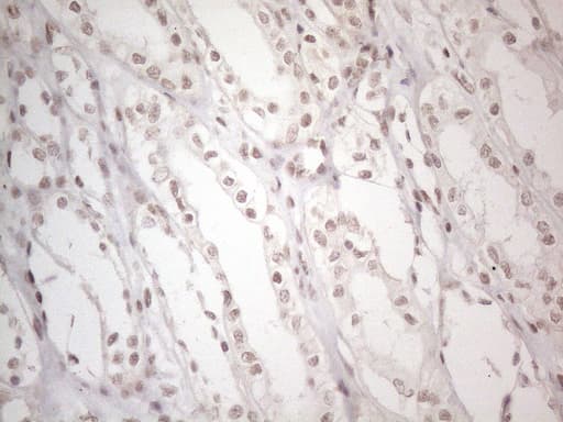 NR2C2 / TAK1 Antibody (aa1-241, clone OTI4B1)
