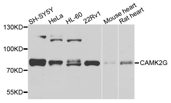 CAMK2G / CaMK II Gamma Antibody