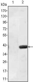 MATN1 / Matrilin 1 Antibody (clone 5A8)