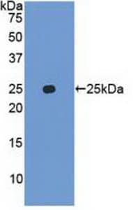 FAT10 / UBD Antibody (aa1-165, APC)