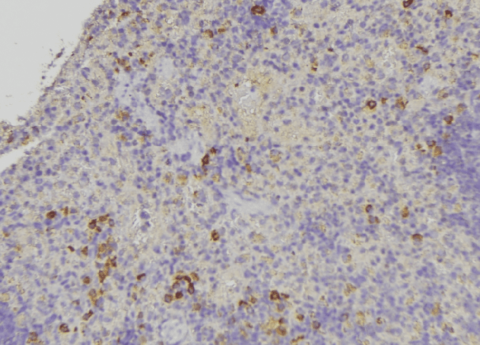 KRT31 / Keratin 31 / KRTHA1 Antibody