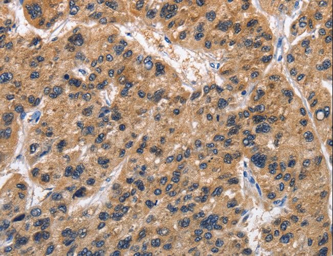 TARSH / ABI3BP Antibody