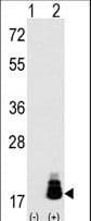 EIF4EBP1 / 4EBP1 Antibody (Thr69)