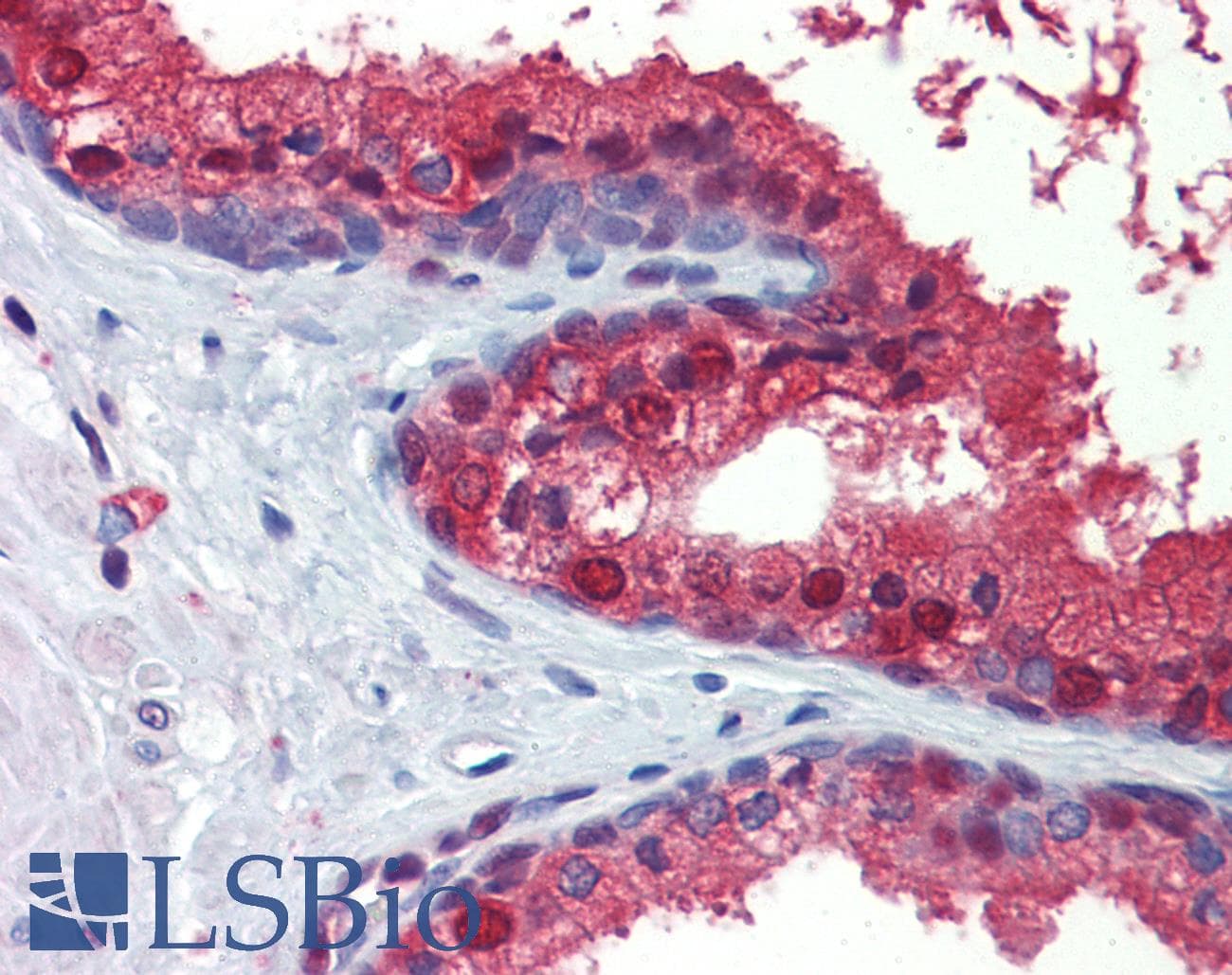 Monoclonal Mouse anti-Human ACLY / ATP Citrate Lyase Antibody (clone 3G8, Carrier-free, IHC, IF, WB)