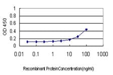 AKT1 Antibody (clone 6G6)
