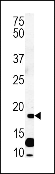 C6orf108 Antibody (aa20-48)