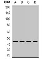 CCNB2 / Cyclin B2 Antibody
