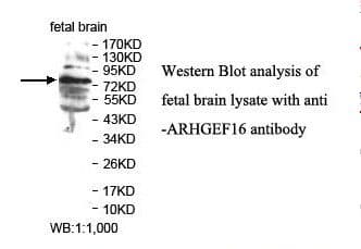 Polyclonal Rabbit anti-Human ARHGEF16 Antibody (aa84-256, IHC, WB)