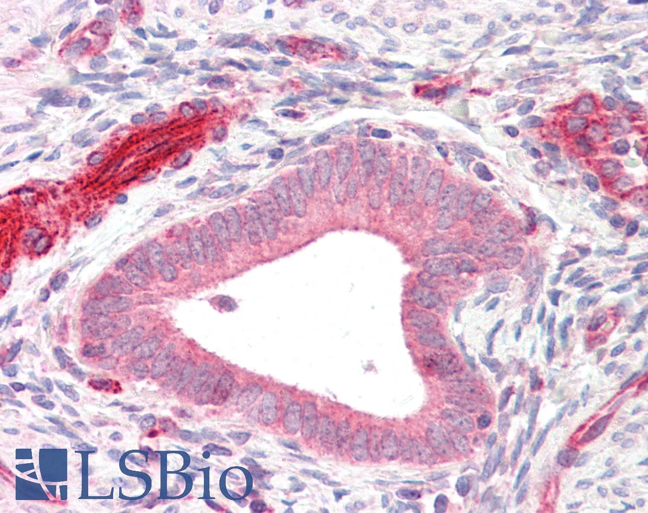 IHC-plus™ Polyclonal Rabbit anti-Human ADAM33 Antibody (IHC, WB)