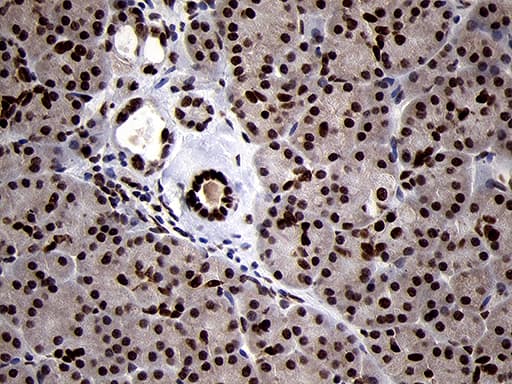 Monoclonal Mouse anti-Human SMC1A / SMC1 Antibody (clone OTI3G4, aa889-1016, IHC, WB)
