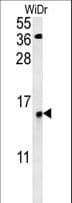Polyclonal Rabbit anti-Human KXD1 / C19orf50 Antibody (aa59-85, IHC, WB)