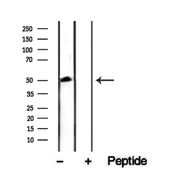 CKMT1 Antibody