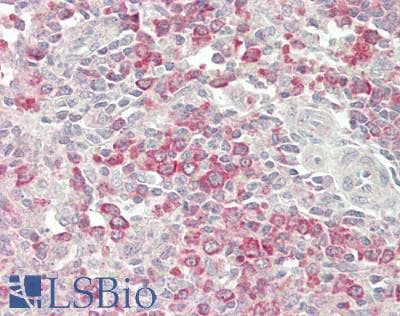 IHC-plus™ Polyclonal Rabbit anti-Human GAPVD1 Antibody (aa550-600, IHC, WB)