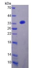 Human CYBB / NOX2 / gp91phox Protein (Recombinant His, N-Terminal)