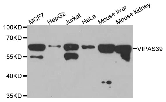 Polyclonal Rabbit anti-Human VIPAS39 Antibody (WB)