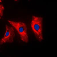 Polyclonal Rabbit anti-Human Vimentin Antibody (C-Terminus, IHC, IF, WB)