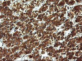 ERGIC-53 / LMAN1 Antibody (clone OTI1C5)