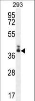 SARAF / TMEM66 Antibody (aa33-62)