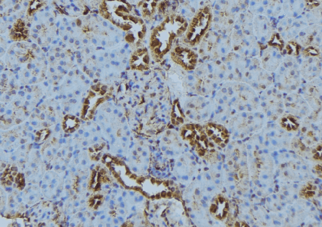 IFT140 Antibody