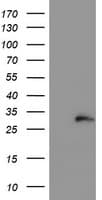 COMMD1 Antibody (clone OTI2D10)