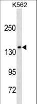 IHC-plus™ Polyclonal Rabbit anti-Human AFF1 / AF4 Antibody (aa1181-1210, IHC, WB)