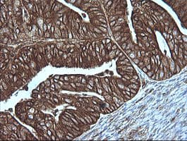 MAP2K1 / MKK1 / MEK1 Antibody (clone OTI4E4)