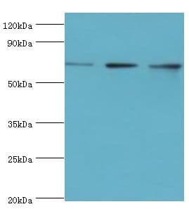 Polyclonal Rabbit anti-Human DDX5 Antibody (aa1-290, IHC, WB)