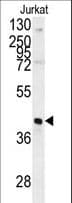 IHC-plus™ Polyclonal Rabbit anti-Human FBP1 Antibody (aa1-31, IHC, WB)