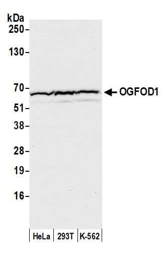 OGFOD1 Antibody (aa1-50)