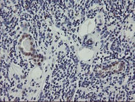RBPMS / Hermes Antibody (clone OTI3D10)