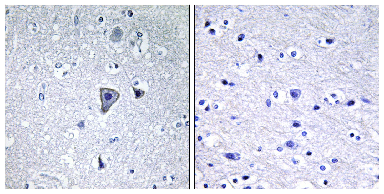 Polyclonal Rabbit anti-Human GRM1 / MGLUR1 Antibody (aa251-300, IHC)
