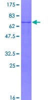 Human PITX1 Protein (Recombinant GST)
