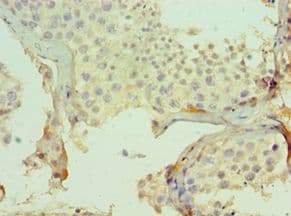 CMA1 / Mast Cell Chymase Antibody (aa1-247)