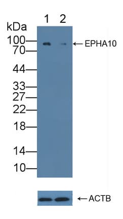 EPHA10 / EPH Receptor A10 Antibody (aa645-900)