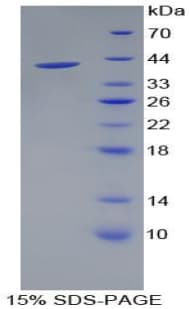 Rat CD144 / CDH5 / VE Cadherin Protein (Recombinant His-T7)
