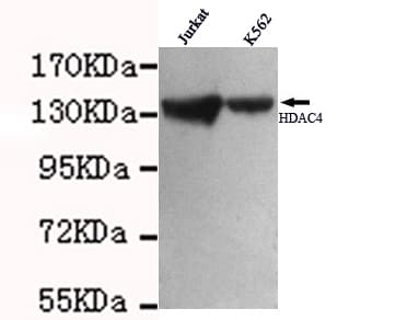 Monoclonal Mouse anti-Human HDAC4 Antibody (N-Terminus, IF, WB)
