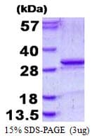 Human KLK5 / Kallikrein 5 Protein (Recombinant His)