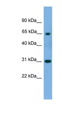 PNKP Antibody (aa359-408)
