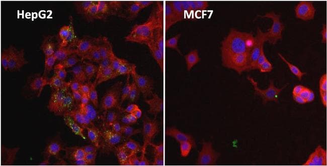 Ferritin Antibody (clone 513C10)