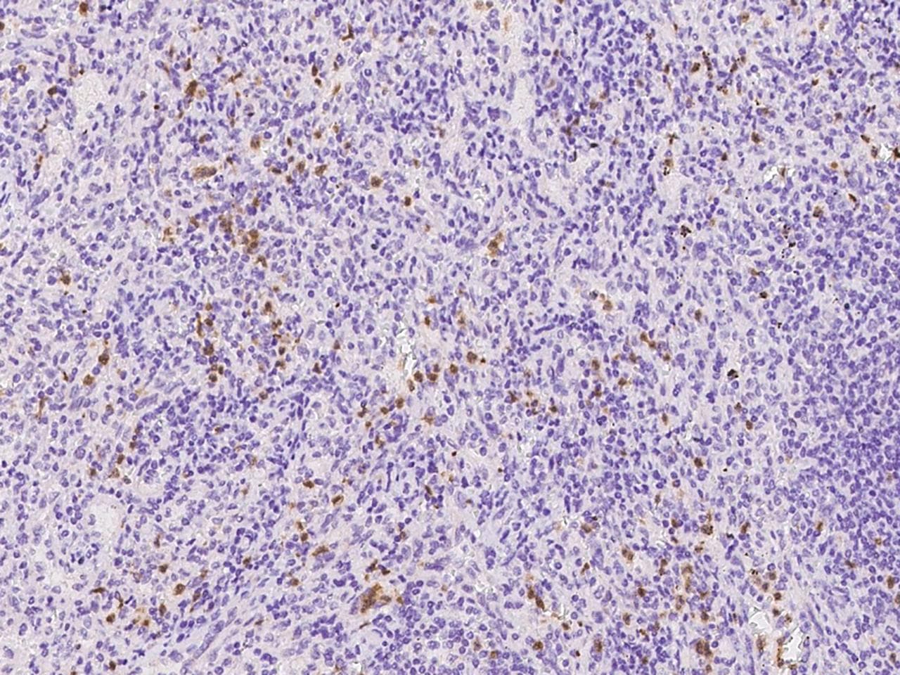 Polyclonal Rabbit anti-Human NCF1 / p47phox / p47 phox Antibody (IHC)