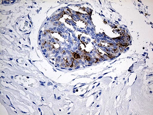 Monoclonal Mouse anti-Human TFF1 / pS2 Antibody (clone OTI1A4, aa25-84, IHC, WB)