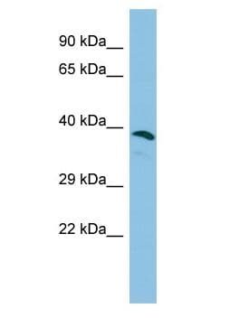 Polyclonal Rabbit anti-Human ERICH1 Antibody (aa160-209, WB)