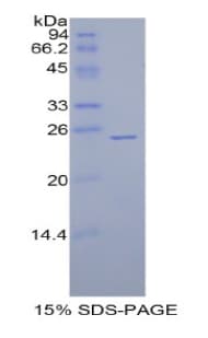 Rat GPX5 Protein (Recombinant His)