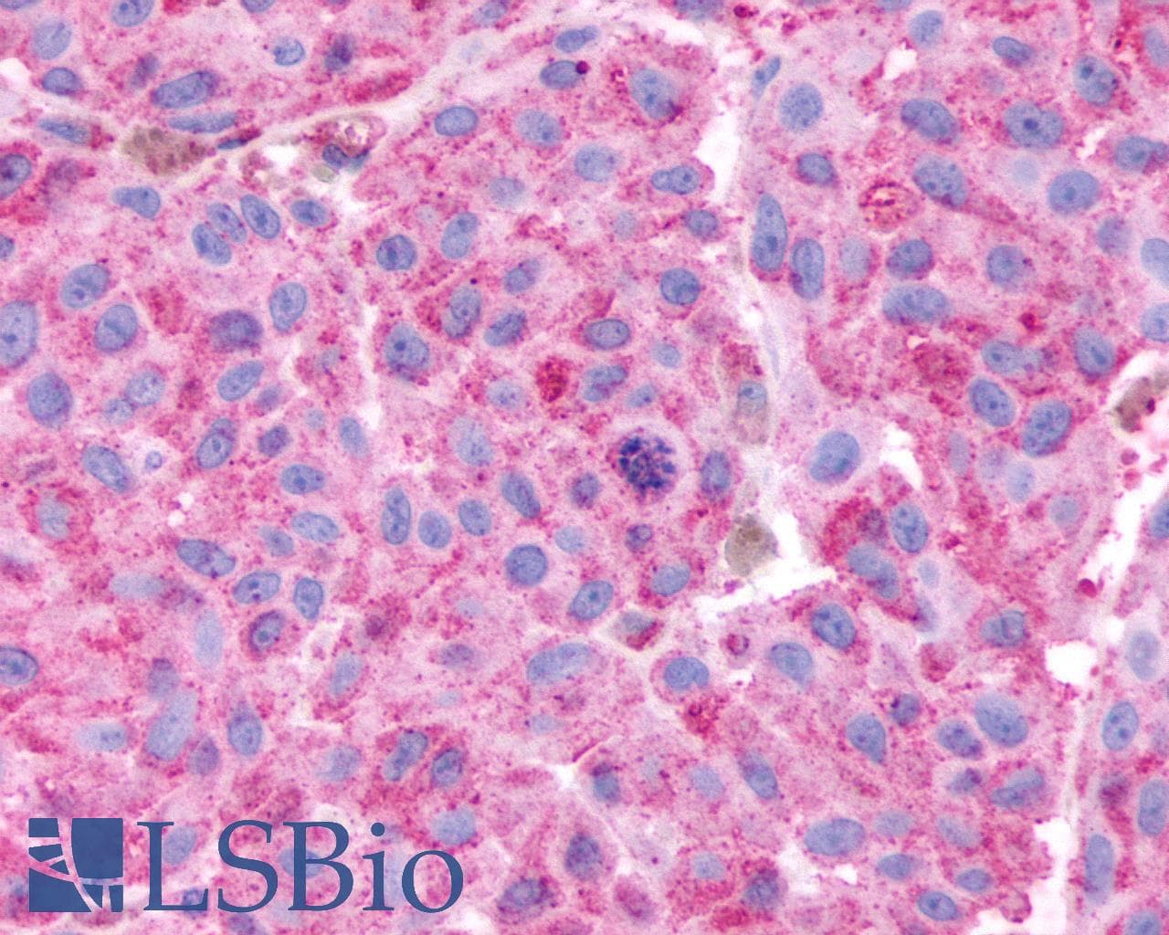 PathPlus™ ADGRE3 / EMR3 Antibody (N-Terminus)