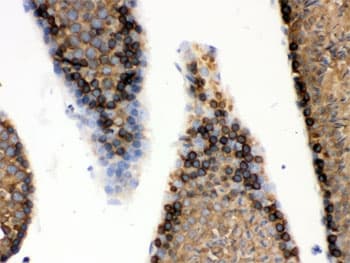 HSPA5 / GRP78 / BiP Antibody