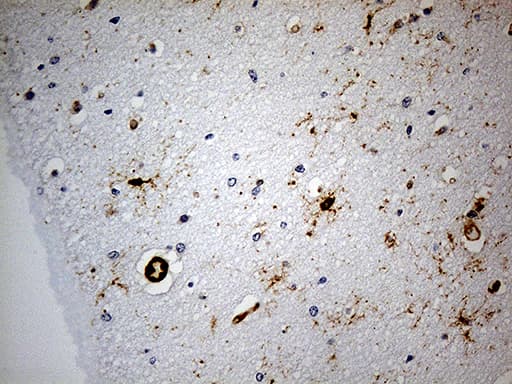 GPR17 Antibody (clone OTI9D6, Carrier-free)