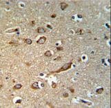 GPR180 Antibody (aa119-147)