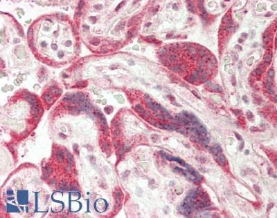 IHC-plus™ RBM22 Antibody (aa175-225)
