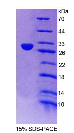 Human BIRC1 / NAIP Protein (Recombinant His-T7)